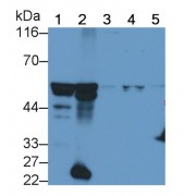 Western blot analysis of (1) Mouse Cerebrum lysate, (2) Mouse Cerebellum lysate, (3) HeLa cell lysate, (4) U87MG cell lysate, and (5) A549 cell lysate.