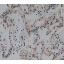 Surfactant Associated Protein A2 (SPA2) Antibody