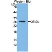 Western blot analysis of the recombinant protein.