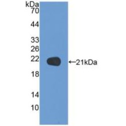 N-Ethylmaleimide Sensitive Factor (NSF) Antibody