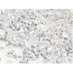 N-Ethylmaleimide Sensitive Factor (NSF) Antibody