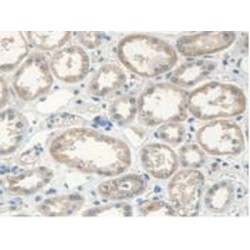 N-Ethylmaleimide Sensitive Factor (NSF) Antibody