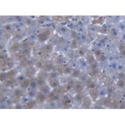 Mitochondrial Carnitine/Acylcarnitine Carrier Protein (SLC25A20) Antibody