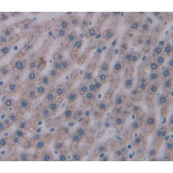 Mitochondrial Carnitine/Acylcarnitine Carrier Protein (SLC25A20) Antibody