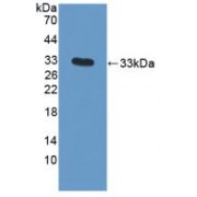 Western blot analysis of recombinant Human SNAI1.