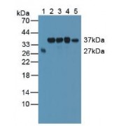 Western blot analysis of (1) Human Serum, (2) Human HeLa cells, (3) Human HepG2 Cells, (4) Human 293T Cells and (5) Mouse Testis Tissue.