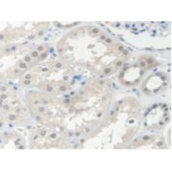 Survival of Motor Neuron 2, Centromeric (SMN2) Antibody