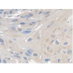 Survival of Motor Neuron 2, Centromeric (SMN2) Antibody