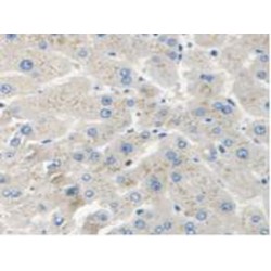 Survival of Motor Neuron 2, Centromeric (SMN2) Antibody