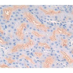 Neutral Sphingomyelinase (NSMASE) Antibody