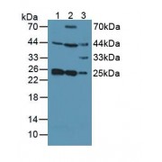 Western blot analysis of (1) Human Lung Tissue, (2) Human HeLa cells and (3) Mouse Placenta Tissue.