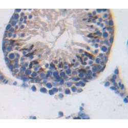 Sperm Protein 17 (Sp17) Antibody