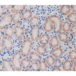 Sterol Regulatory Element Binding Transcription Factor 1 (SREBF1) Antibody