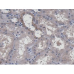 Developmental Pluripotency Associated Protein 3 (DPPA3) Antibody