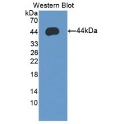 Western blot analysis of the recombinant Human SYCN protein.