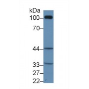 Western blot analysis of Rat Kidney lysate, using Human TP Antibody (1 µg/ml) and HRP-conjugated Goat Anti-Rabbit antibody (<a href="https://www.abbexa.com/index.php?route=product/search&amp;search=abx400043" target="_blank">abx400043</a>, 0.2 µg/ml).