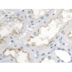 Thromboxane Receptor (TP) Antibody