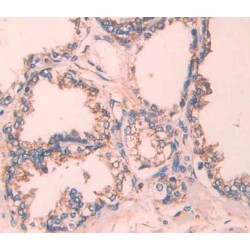 Transcobalamin II, Macrocytic Anemia (TCN2) Antibody