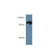 Western blot analysis of Mouse Skeletal muscle lysate, using Rat TRDN Antibody (1 µg/ml) and HRP-conjugated Goat Anti-Rabbit antibody (<a href="https://www.abbexa.com/index.php?route=product/search&amp;search=abx400043" target="_blank">abx400043</a>, 0.2 µg/ml).