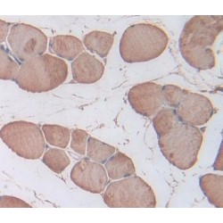 Triadin (TRDN) Antibody