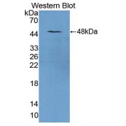 Western blot analysis of recombinant Mouse TRDN protein.
