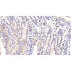 Transforming Growth Factor Beta 3 (TGFb3) Antibody