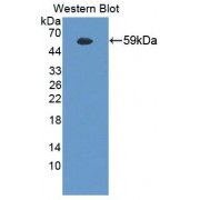 Western blot analysis of recombinant Human RARRES1 Protein.