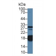 Western blot analysis of Pig Heart lysate, using Human TNNC1 Antibody (1 µg/ml) and HRP-conjugated Goat Anti-Rabbit antibody (<a href="https://www.abbexa.com/index.php?route=product/search&amp;search=abx400043" target="_blank">abx400043</a>, 0.2 µg/ml).