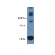 Western blot analysis of Mouse Heart lysate, using Human TNS1 Antibody (1 µg/ml) and HRP-conjugated Goat Anti-Rabbit antibody (<a href="https://www.abbexa.com/index.php?route=product/search&amp;search=abx400043" target="_blank">abx400043</a>, 0.2 µg/ml).