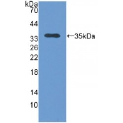 Translocase of Outer Mitochondrial Membrane 70A (TOMM70A) Antibody