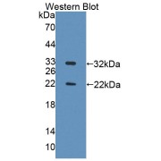 Western blot analysis of the recombinant protein.