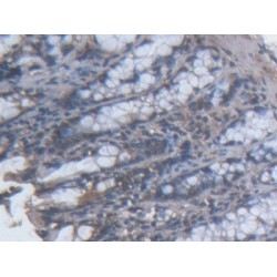 Topoisomerase II Binding Protein 1 (TOPBP1) Antibody