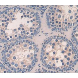 Topoisomerase II Binding Protein 1 (TOPBP1) Antibody