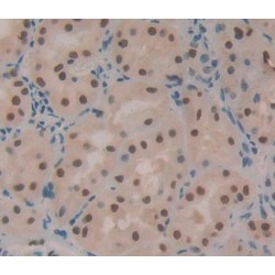 Topoisomerase II Binding Protein 1 (TOPBP1) Antibody