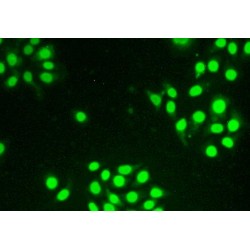 Thymopoietin (TMPO) Antibody