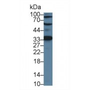 Western blot analysis of Human Jurkat cell lysate, using Mouse ACD Antibody (1 µg/ml) and HRP-conjugated Goat Anti-Rabbit antibody (<a href="https://www.abbexa.com/index.php?route=product/search&amp;search=abx400043" target="_blank">abx400043</a>, 0.2 µg/ml).