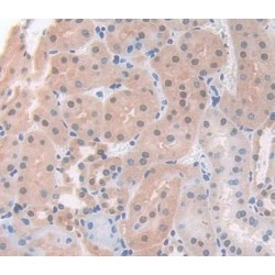 Adrenocortical Dysplasia Homolog (ACD) Antibody