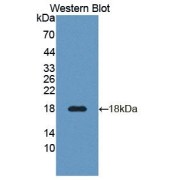 Western blot analysis of the recombinant protein.