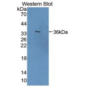 Western blot analysis of the recombinant protein.