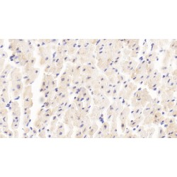 Myomesin 2 (MYOM2) Antibody