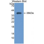 Western blot analysis of the recombinant Human MYOM2 protein.