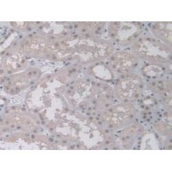 Polyubiquitin-B (UBB) Antibody