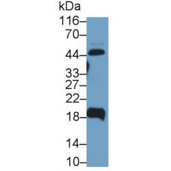Uroplakin 2 (UPK2) Antibody