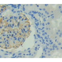 Transient Receptor Potential Cation Channel Subfamily V, Member 1 (TRPV1) Antibody