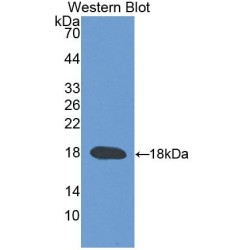 Transient Receptor Potential Cation Channel Subfamily V, Member 3 (TRPV3) Antibody