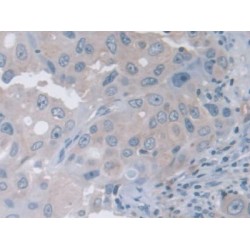 Transient Receptor Potential Cation Channel Subfamily V, Member 3 (TRPV3) Antibody