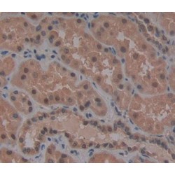 Wilms Tumor Protein (WT1) Antibody