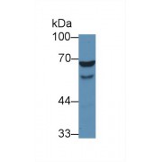 Western blot analysis of Human HL60 cell lysate, using Human WASP Antibody (1 µg/ml) and HRP-conjugated Goat Anti-Rabbit antibody (<a href="https://www.abbexa.com/index.php?route=product/search&amp;search=abx400043" target="_blank">abx400043</a>, 0.2 µg/ml).