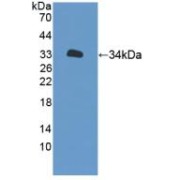 Western blot analysis of recombinant Human XYLT2.