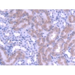 Metal Regulatory Transcription Factor 1 (MTF1) Antibody